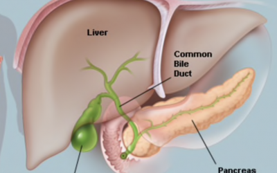 Do you suffer from acid reflux?